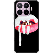 Чохол BoxFace Xiaomi 17T 