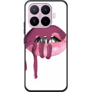Чохол BoxFace Xiaomi 17T 