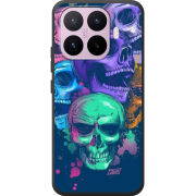 Чохол BoxFace Xiaomi 17T 