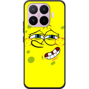Чохол BoxFace Xiaomi 17T 