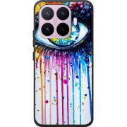 Чохол BoxFace Xiaomi 17T 