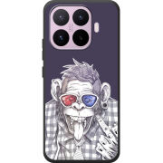 Чохол BoxFace Xiaomi 17T 