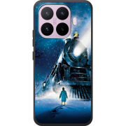 Чохол BoxFace Xiaomi 17T 