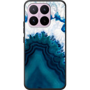 Чохол BoxFace Xiaomi 17T 