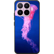 Чохол BoxFace Xiaomi 17T 
