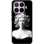 Чохол BoxFace Xiaomi 17T 