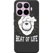 Чохол BoxFace Xiaomi 17T 