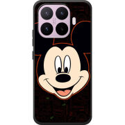 Чохол BoxFace Xiaomi 17T 