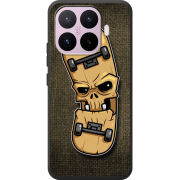 Чохол BoxFace Xiaomi 17T 