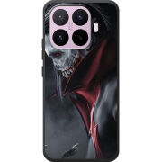 Чохол BoxFace Xiaomi 17T 