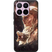 Чохол BoxFace Xiaomi 17T 