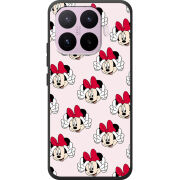 Чохол BoxFace Xiaomi 17T 