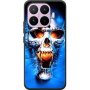 Чохол BoxFace Xiaomi 17T 