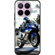 Чохол BoxFace Xiaomi 17T 