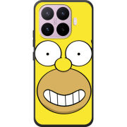 Чохол BoxFace Xiaomi 17T 