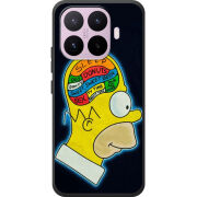 Чохол BoxFace Xiaomi 17T 