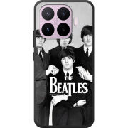 Чохол BoxFace Xiaomi 17T 