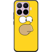 Чохол BoxFace Xiaomi 17T 