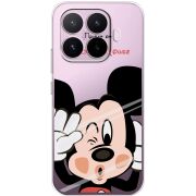 Прозорий чохол BoxFace Xiaomi 17T Mister M