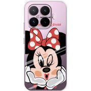 Прозорий чохол BoxFace Xiaomi 17T Lady M