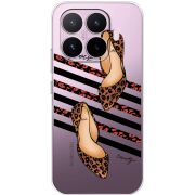 Прозорий чохол BoxFace Xiaomi 17T Love Beauty
