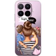 Прозорий чохол BoxFace Xiaomi 17T Super Mama