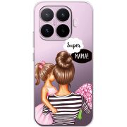 Прозорий чохол BoxFace Xiaomi 17T Super Mama and Daughter
