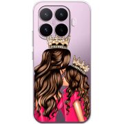 Прозорий чохол BoxFace Xiaomi 17T Queen and Princess