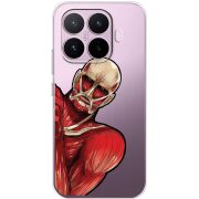 Прозорий чохол BoxFace Xiaomi 17T Титан