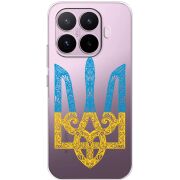 Прозорий чохол BoxFace Xiaomi 17T Gold Trident