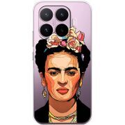 Прозорий чохол BoxFace Xiaomi 17T Фрида Кало