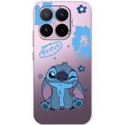 Прозорий чохол BoxFace Xiaomi 17T 