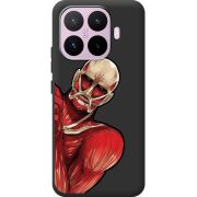 Чорний чохол BoxFace Xiaomi 17T Титан