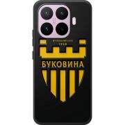 Чорний чохол BoxFace Xiaomi 17T 