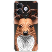 Чохол BoxFace Xiaomi Redmi Note 17 Pro 