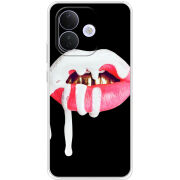 Чохол BoxFace Xiaomi Redmi Note 17 Pro 