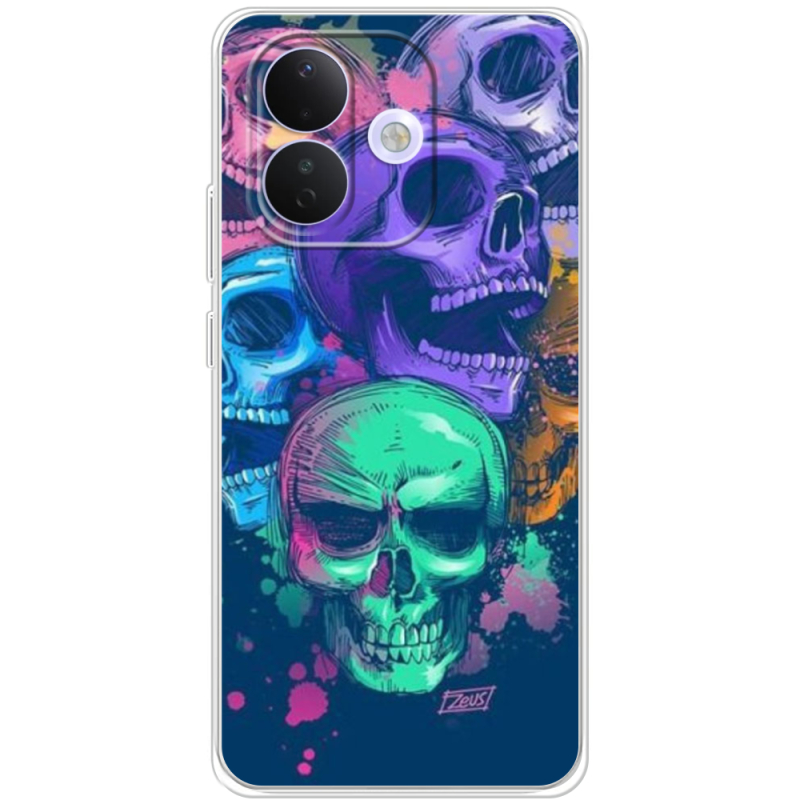 Чохол BoxFace Xiaomi Redmi Note 17 Pro 