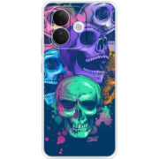 Чохол BoxFace Xiaomi Redmi Note 17 Pro 