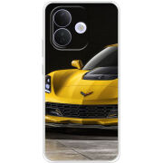 Чохол BoxFace Xiaomi Redmi Note 17 Pro Corvette Z06