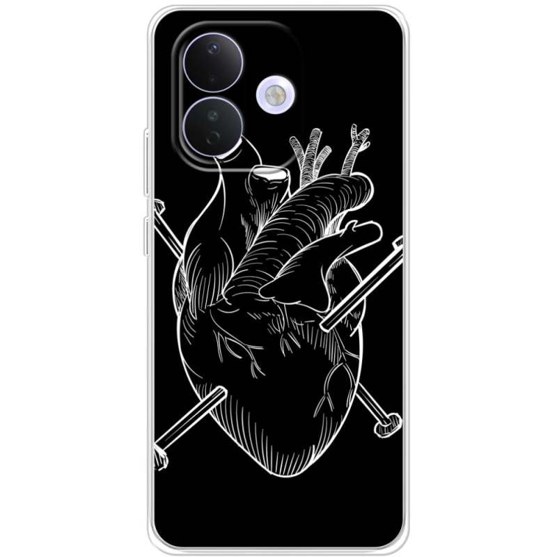 Чохол BoxFace Xiaomi Redmi Note 17 Pro 