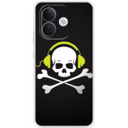 Чохол BoxFace Xiaomi Redmi Note 17 Pro 