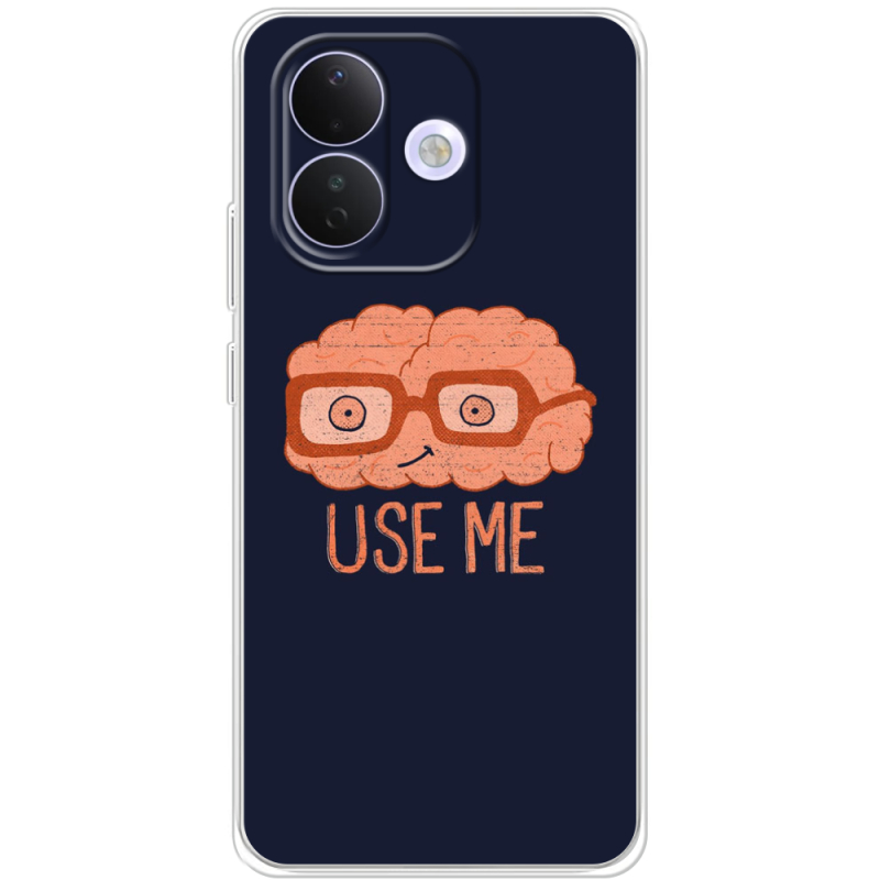 Чохол BoxFace Xiaomi Redmi Note 17 Pro 