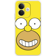 Чохол BoxFace Xiaomi Redmi Note 17 Pro 