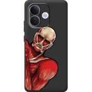 Чорний чохол BoxFace Xiaomi Redmi Note 17 Pro Титан