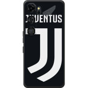 Чохол BoxFace Nubia Neo 5 GT 5G FC J