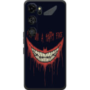 Чохол BoxFace Nubia Neo 5 GT 5G 