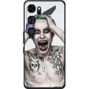 Чохол BoxFace Nubia Neo 5 GT 5G 