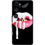 Чохол BoxFace Nubia Neo 5 GT 5G 