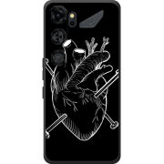 Чохол BoxFace Nubia Neo 5 GT 5G 
