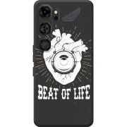 Чохол BoxFace Nubia Neo 5 GT 5G 